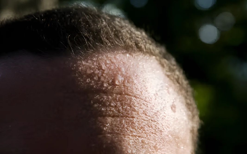 Cách trị đổ mồ hôi đầu ở người lớn: Giải pháp đơn giản nhưng hiệu quả 2