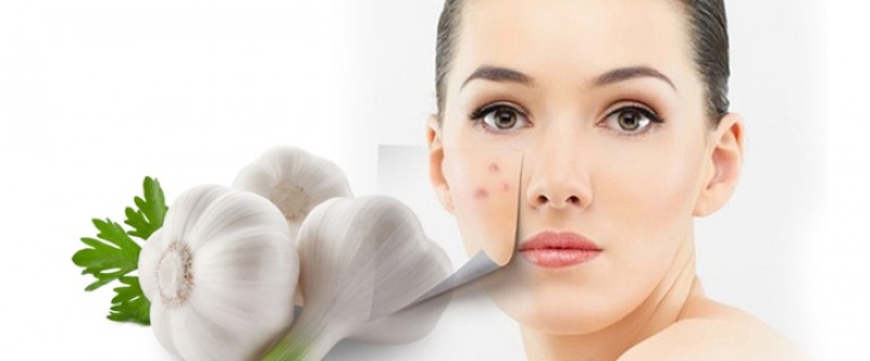 Cách trị đồi mồi bằng tỏi phổ biến nhất hiện nay 2