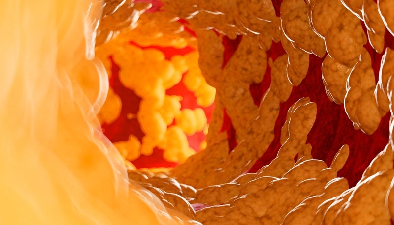 Cách trị gan nhiễm mỡ​ an toàn, hiệu quả đọc ngay kẻo lỡ 3