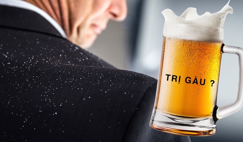 Cách trị gàu bằng bia có hiệu quả không? Cách thực hiện như thế nào? 1