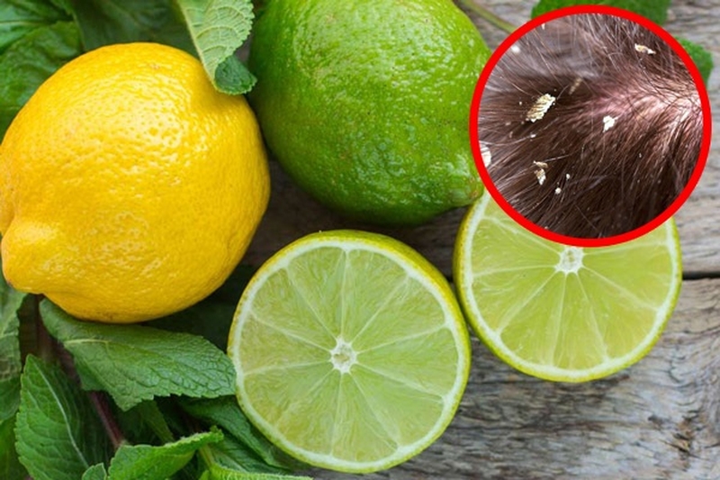 trị gàu bằng chanh tươi 1