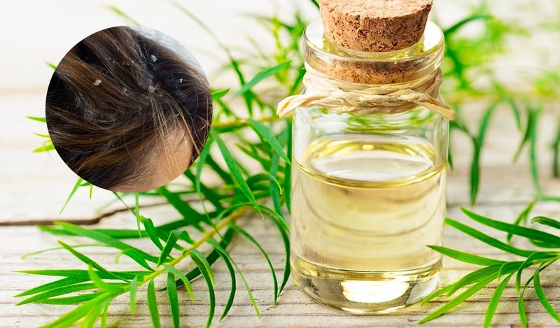 Cách trị gàu mùa đông hiệu quả và nguyên nhân gây nên hiện tượng này 3