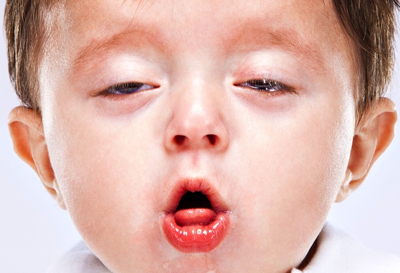 Cách trị ho cực đơn giản mà không cần dùng thuốc