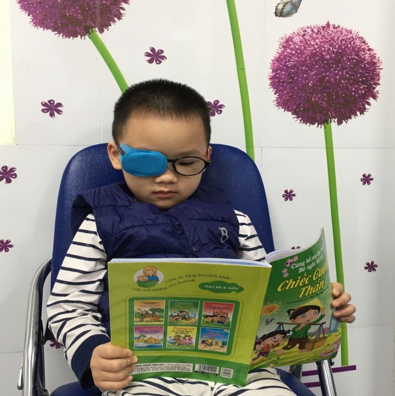 Cách trị mắt lác nhẹ hiệu quả 3