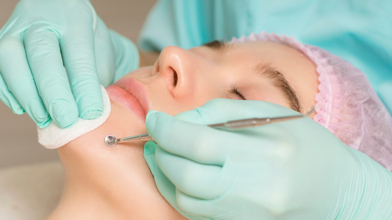 Cách trị mụn đầu đen với sữa tươi: phương pháp hiệu quả từ tự nhiên 3