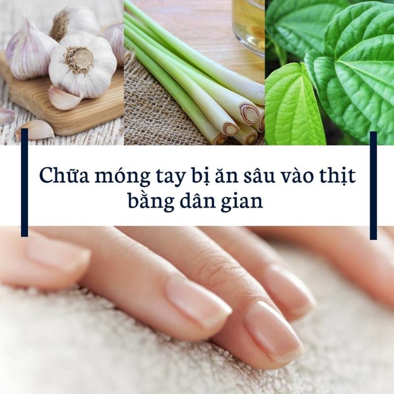Cách trị nấm móng tay dứt điểm an toàn và hiệu quả 4