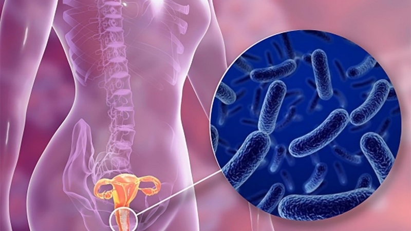 Cách trị ngứa vùng kín tại nhà an toàn hiệu quả mà bạn nên biết 3