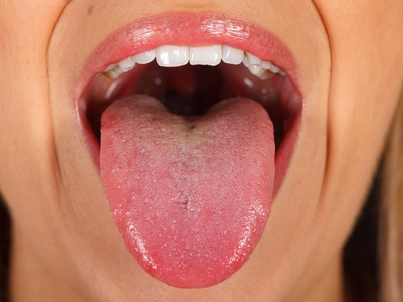 Cách trị nhiệt lưỡi nhanh, gọn, lẹ tại nhà giúp mang lại hiệu quả cao 1