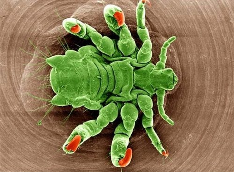 Cách trị rận mu bằng dân gian đơn giản hiệu quả 1