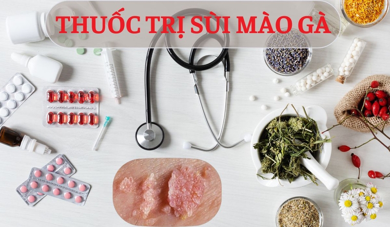 Cách trị sùi mào gà ở nữ và các biện pháp phòng ngừa bệnh sùi mào gà 2