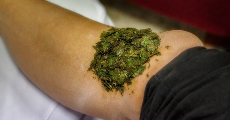 Cách trị tổ đỉa bằng lá đào 2