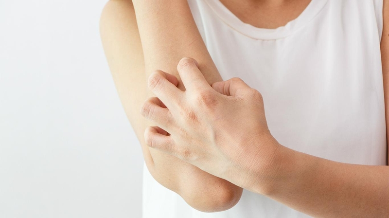 Cách trị viêm nang lông bằng lá trầu không1