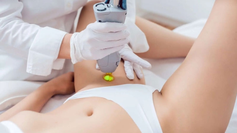 Bật mí cách triệt lông bikini bằng máy tại nhà 3