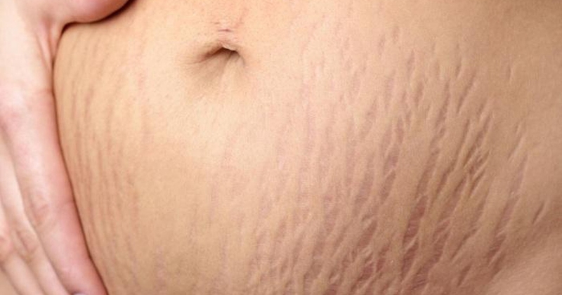 Cách uống bột nghệ sau sinh mổ đúng chuẩn, làm đẹp hiệu quả1