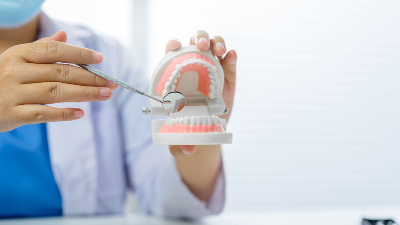 Cách vệ sinh cầu răng sứ đúng chuẩn y khoa 2