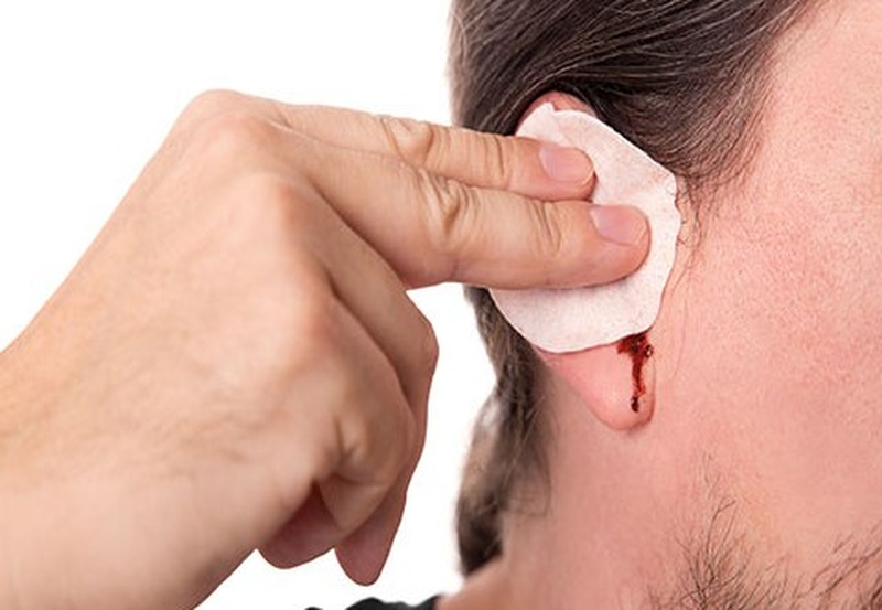 Cách vệ sinh tai khi bị viêm tai ngoài chi tiết nhất