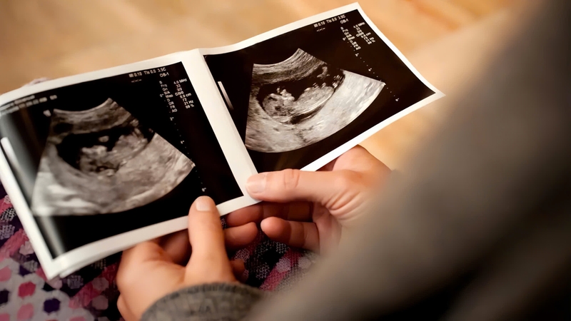 cach-xoay-nhan-cuoi-biet-trai-hay-gai 3