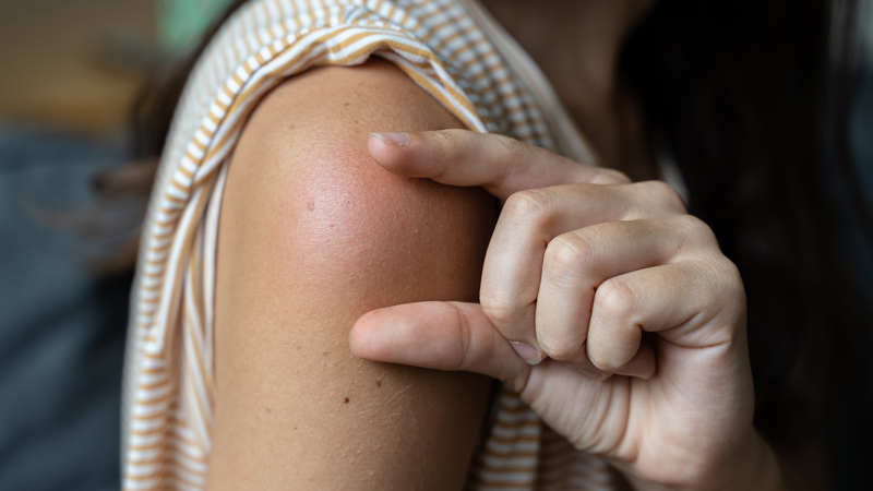 Cách xử lý các phản ứng sau tiêm chủng của trẻ 2