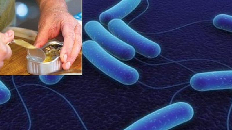 Cách xử lý khi bị nhiễm chất kịch độc do vi khuẩn clostridium botulinum 1