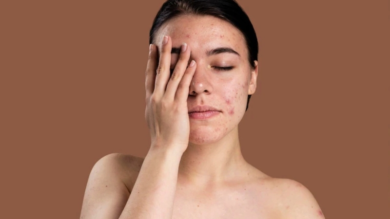 Cảm giác có con gì bò trên mặt có phải dấu hiệu của bệnh lý? 3