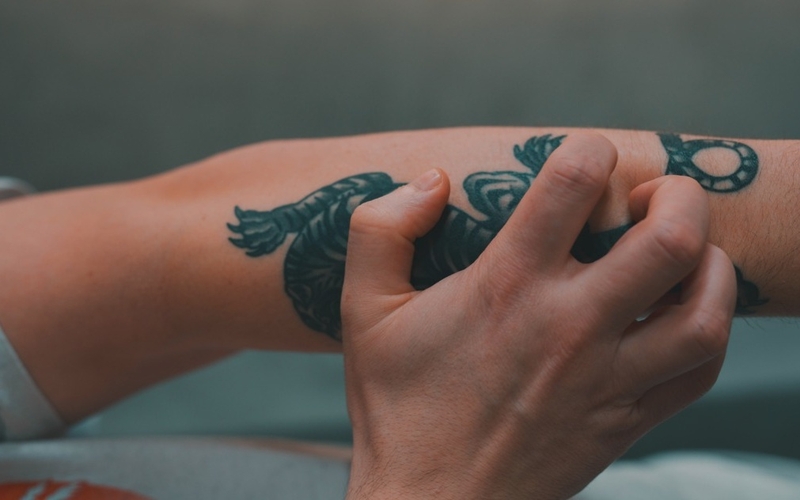 cam-giac-vung-da-hinh-xam-bi-ngua-phai-lam-sao 2.jpg