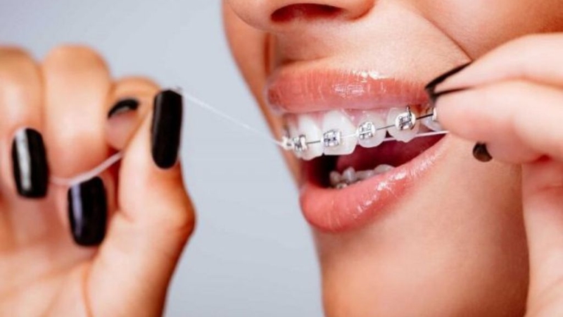 cam-implant-co-nieng-rang-duoc-khong-can-luu-y-gi 2.jpg