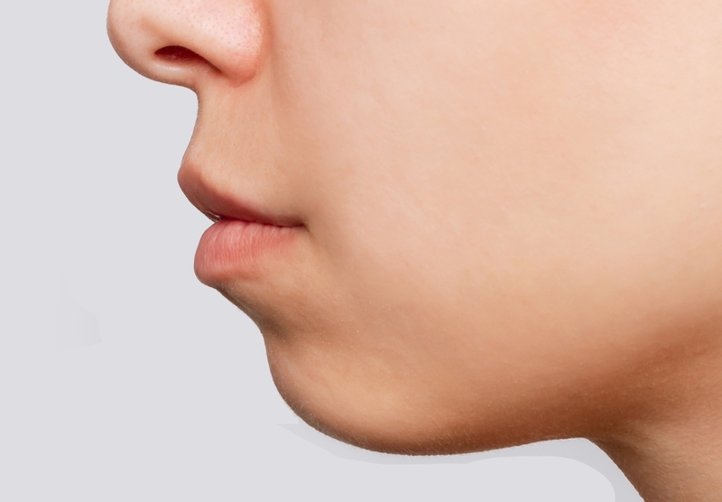 Cằm lẹm: Nguyên nhân, dấu hiệu nhận biết và cách khắc phục 1