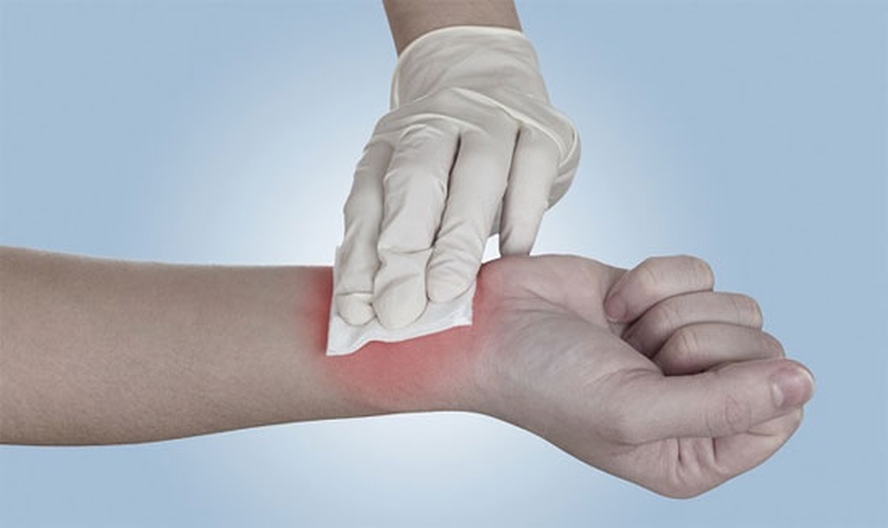Hướng dẫn cách băng bó vết thương đúng chuẩn 2