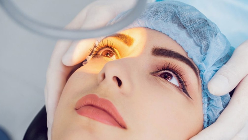 Cận 20 độ có mổ được không và nên lưu ý gì? 2