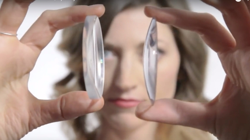 Cận 20 độ có mổ được không và nên lưu ý gì? 1