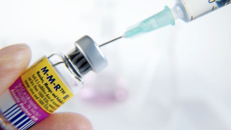 Cần biết gì về xét nghiệm kháng thể sởi? 4