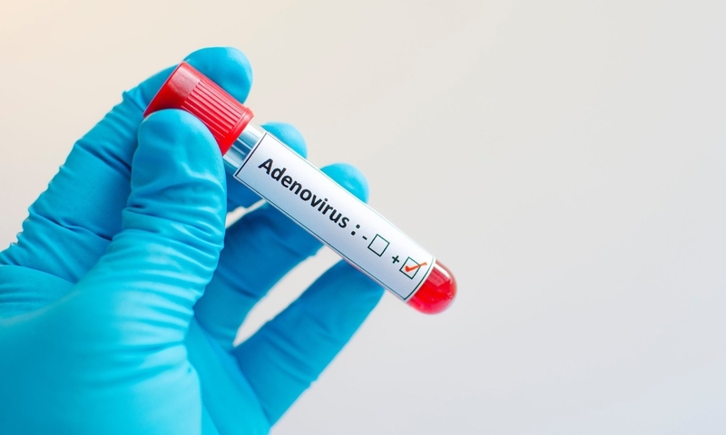 Cần làm những xét nghiệm nào để xác định ca bệnh nhiễm virus Adeno?3