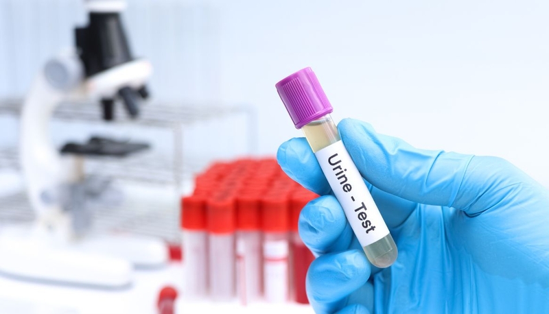 Cận lâm sàng tăng huyết áp: Các xét nghiệm chẩn đoán cần thiết 2