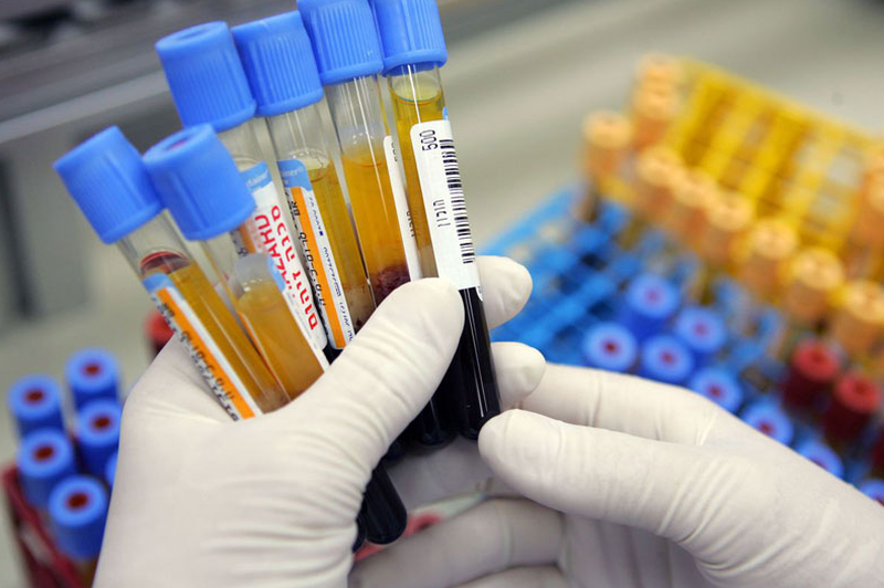 Cần lưu ý gì khi rơi vào nhóm máu hiếm? Có nguy hiểm gì không? 2