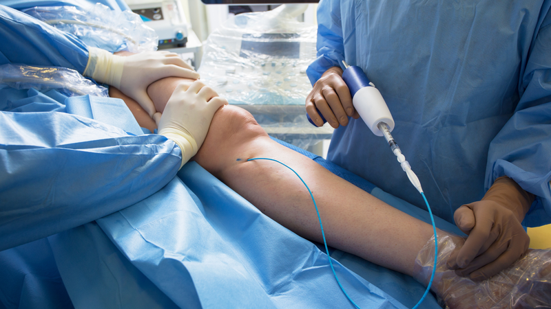 Can thiệp mạch vành qua da và những điều cần biết 4