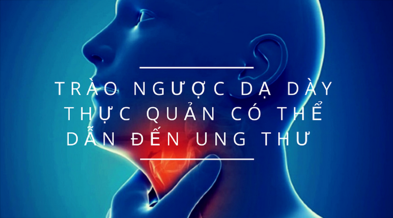 Cẩn trọng nguy cơ trào ngược dạ dày gây ung thư 2