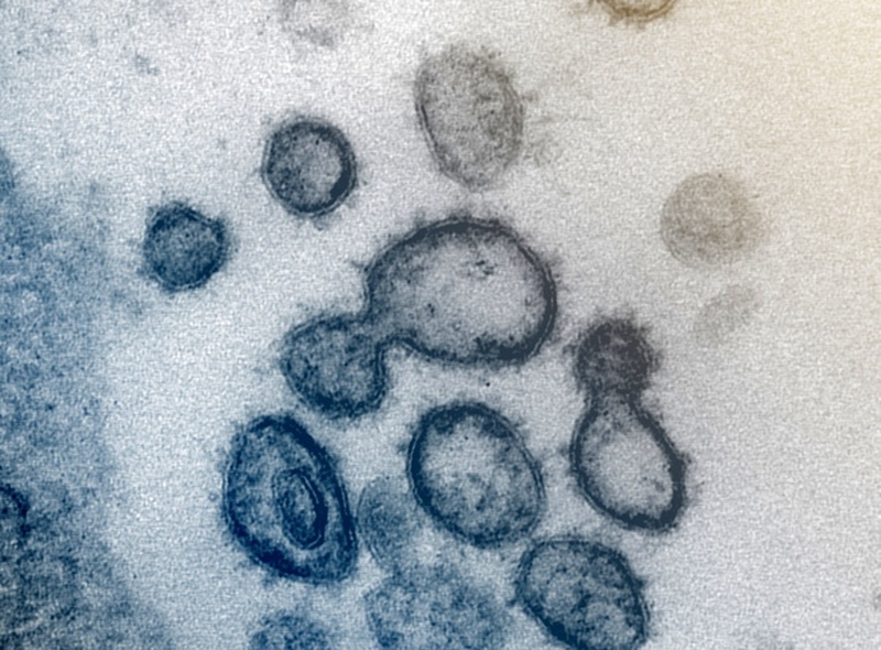 Cẩn trọng: Sử dụng huyết tương diệt Covid-19