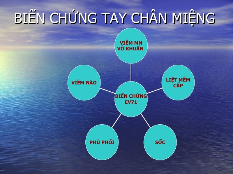 Cẩn trọng với những dấu hiệu của bệnh tay chân miệng