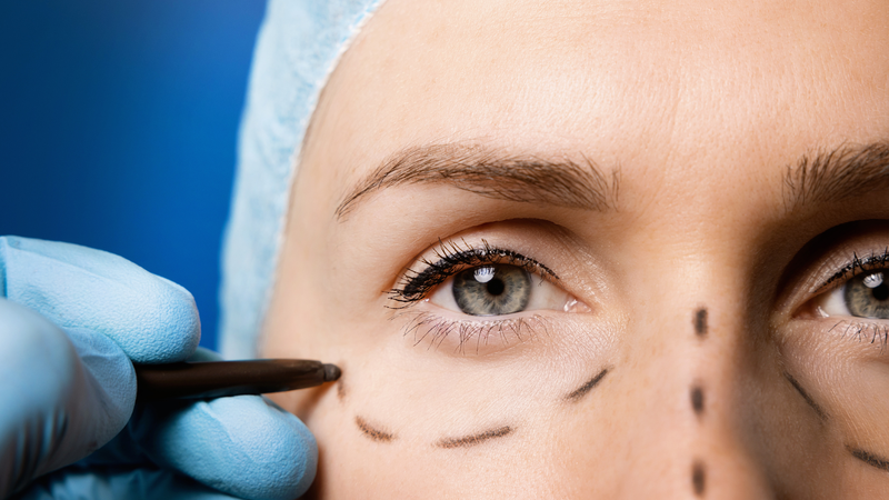 Căng da mặt chỉ vàng: Ưu và nhược điểm nổi bật 4