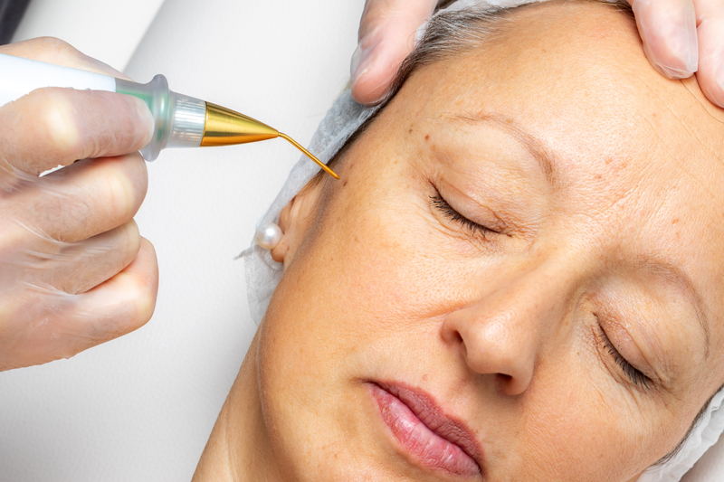 Căng da trán: Ưu, nhược điểm và những điều cần biết! 2