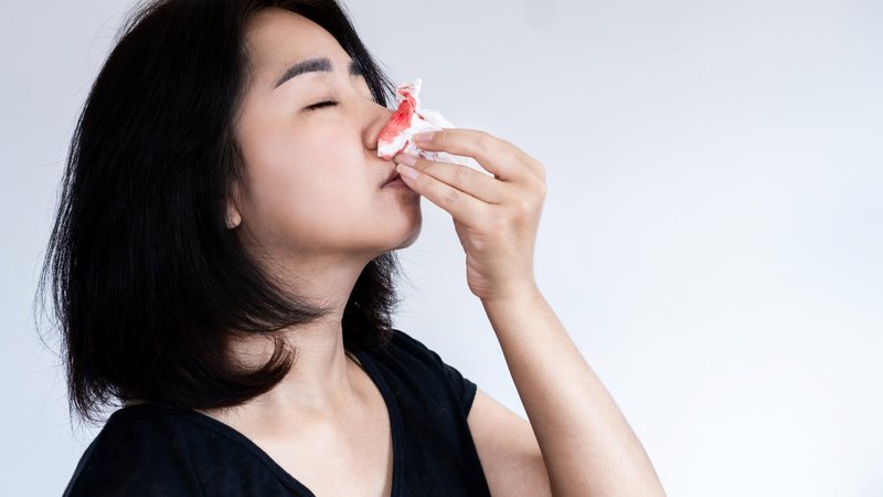 Cảnh báo các bệnh lý nguy hiểm do chảy máu mũi thường xuyên và cách khắc phục hiệu quả 1