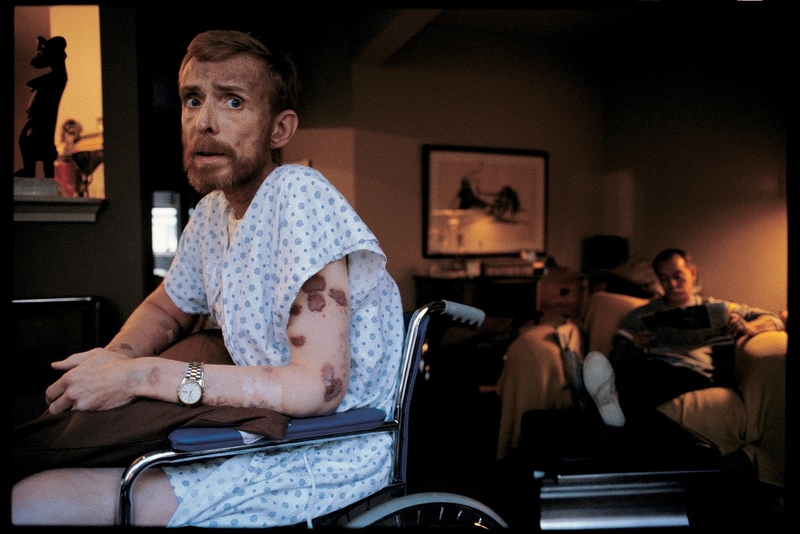 Cảnh báo triệu chứng HIV ở nam theo từng giai đoạn 3