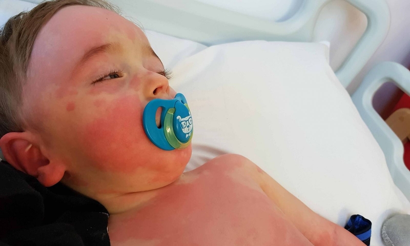 Cảnh báo về biến chứng hiếm gặp của trẻ mắc COVID-19 1