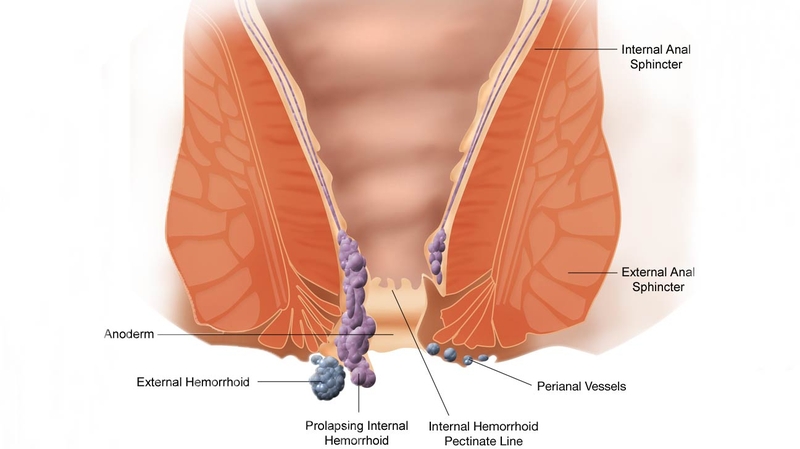 Cảnh giác đối với các bệnh ngoài da ở vùng kín nam giới1
