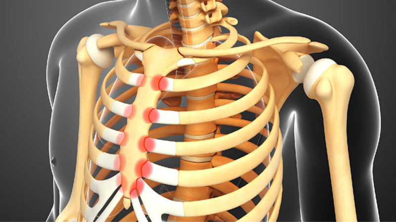 Cảnh giác với dấu hiệu ấn vào xương ức thấy đau 2