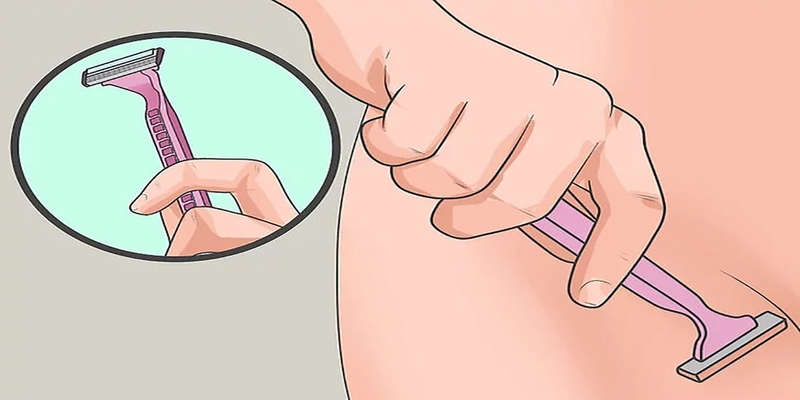 Cạo lông vùng kín bị nổi mụn: Nguyên nhân, hướng xử trí và cách phòng ngừa 4