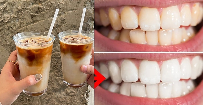 cao-voi-rang-co-anh-huong-gi-khong-va-loi-ich-cua-viec-cao-voi-rang 4.jpg