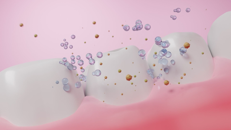 Cao vôi răng độ 1 là gì? Cách nhận biết và quy trình lấy vôi răng độ 1 3