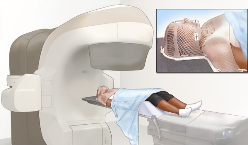 Một số loại thuốc đang được điều chế nhằm tăng cường hiệu quả của xạ trị