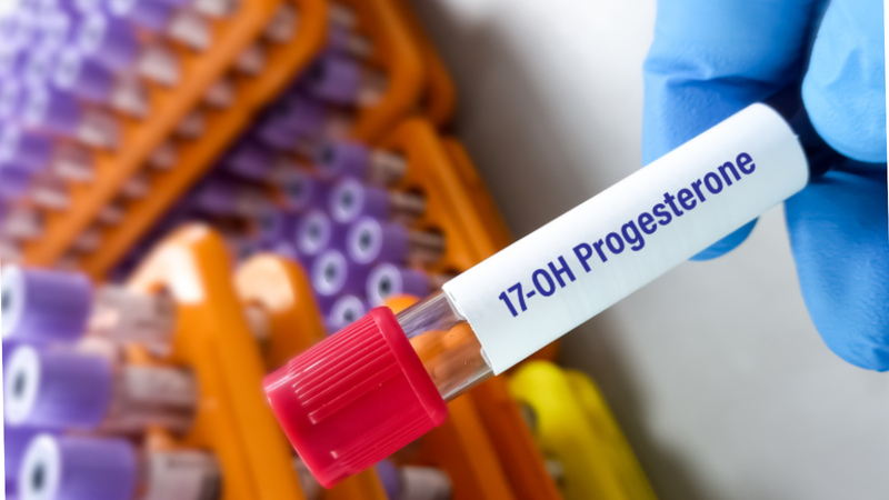 Xét nghiệm progesterone giúp đánh giá khả năng duy trì thai kỳ từ giai đoạn đầu